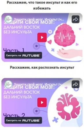 инсульт